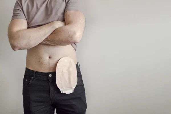 STOMA CARE & PRODUCTS